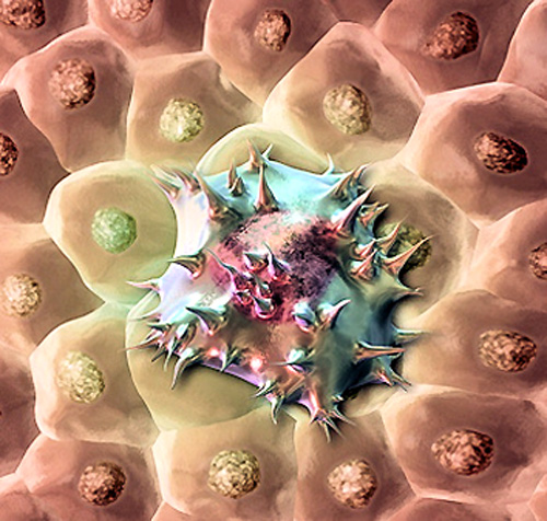 Симптомы рака: первые признаки онкологии в организме человека