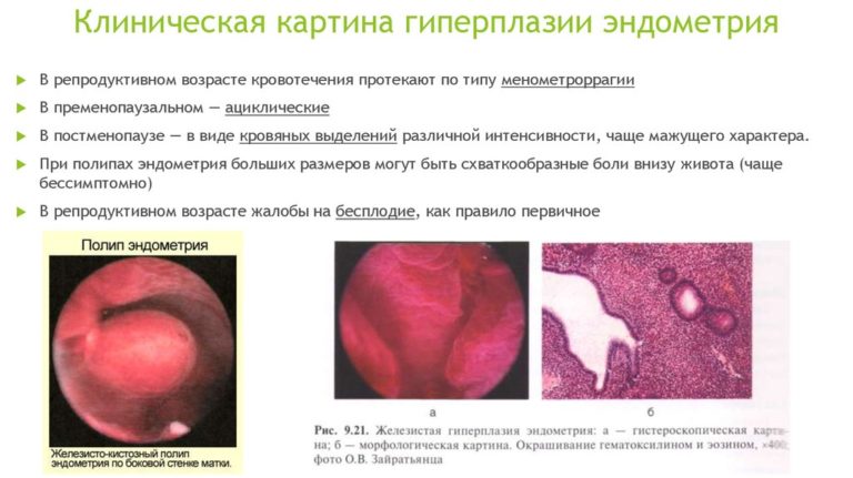 17 опк при гиперплазии эндометрия схема приема