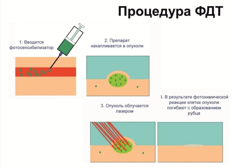 Фотодинамическая диагностика основы и принцип метода презентация