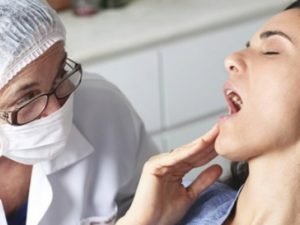 Рак полости рта: все виды локализации, признаки и лечение