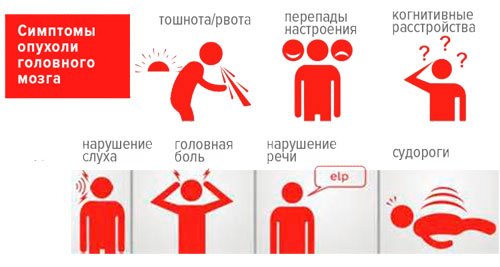 Опухоль головного мозга - симптомы и признаки на ранней стадии