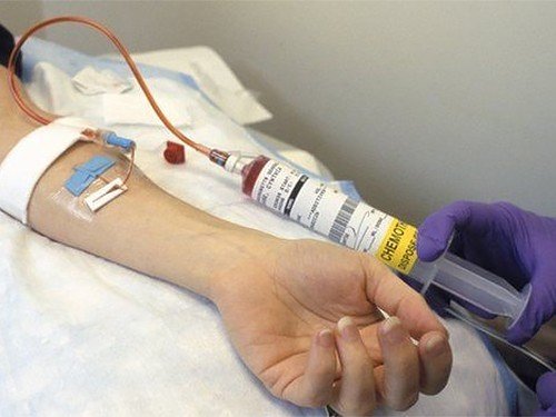 Опухоль головного мозга - симптомы и признаки на ранней стадии