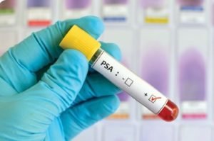 Как понять анализ крови на онкомаркеры