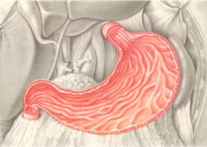желудок - возможное место формирования бластомы