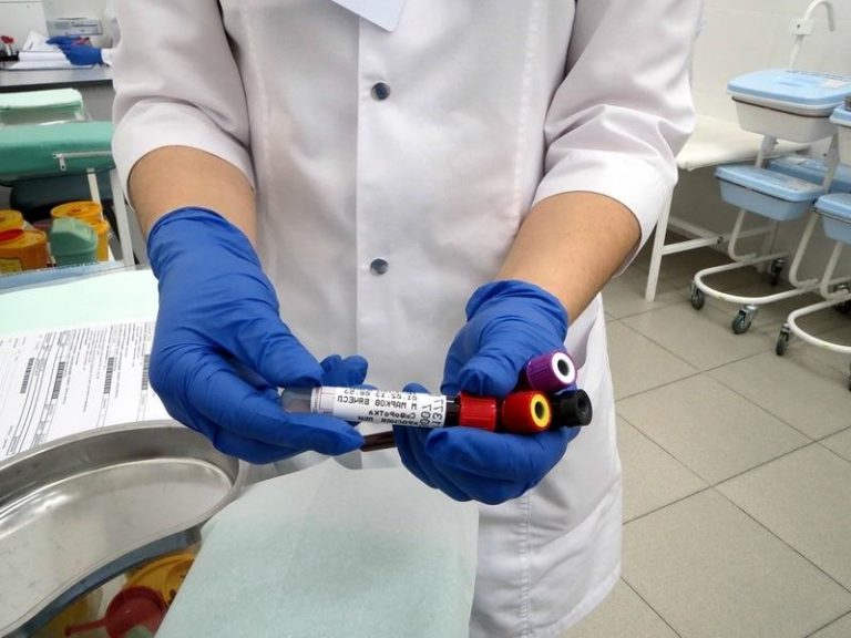 Онкомаркер СА 19-9: что означает, расшифровка и норма