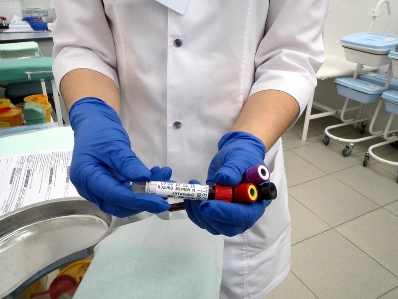 Онкомаркер СА 19-9: что означает, расшифровка и норма