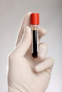 Анализ крови на маркер s100 thumbnail