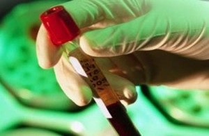 Кровь в пробирке на онкомаркер са-242