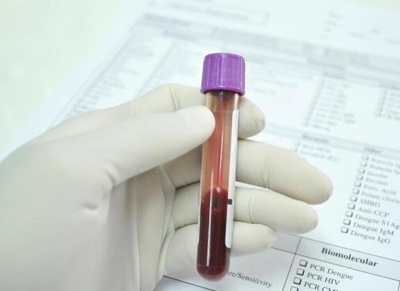 Онкомаркер СА 72-4 - что показывает, норма и расшифровка