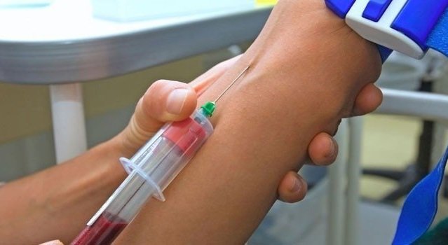 Онкомаркер СА 15-3: что показывает, расшифровка и норма