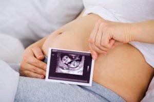 Миома матки и беременность