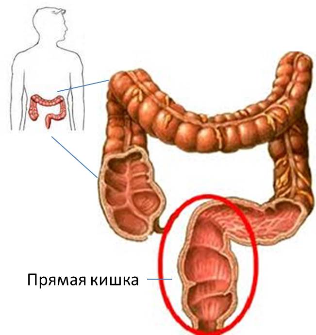 Обследование прямой кишки как называется