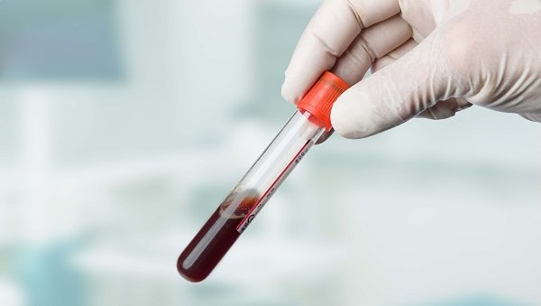 Диагностика эритремии - биохимический анализ крови