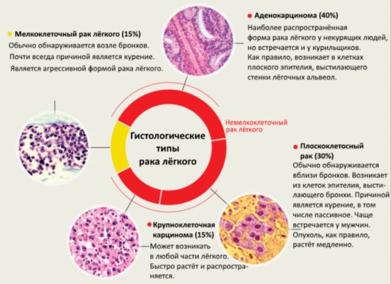 Нейроэндокринные опухоли общие принципы диагностики и лечения руководство